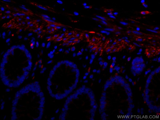 [CL594-67793-100UL] CoraLite®594-conjugated Desmin Monoclonal antibody