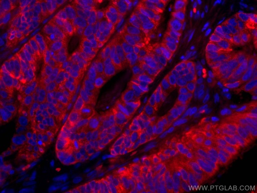 [CL594-67798-100UL] CoraLite®594-conjugated CNOT4 Monoclonal antibody