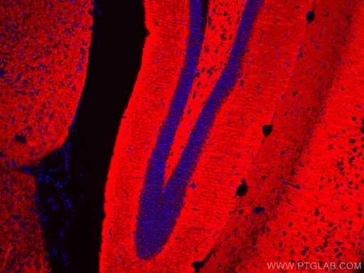 [CL594-67864-100UL] CoraLite®594-conjugated Synaptophysin Monoclonal antibody