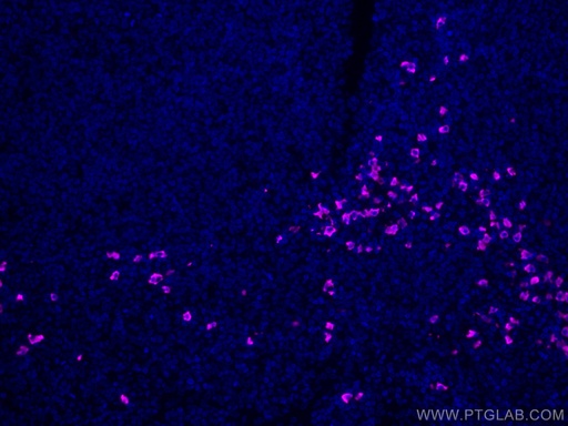 [CL647-11449-100UL] CoraLite®647-conjugated Human IgA Heavy Chain Polyclonal antibody