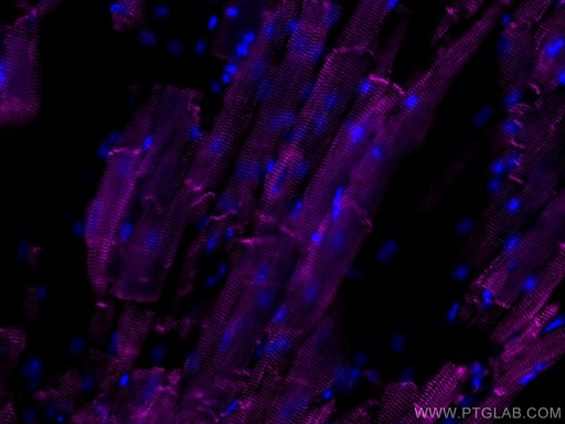 [CL647-16520-100UL] CoraLite®647-conjugated Desmin Polyclonal antibody