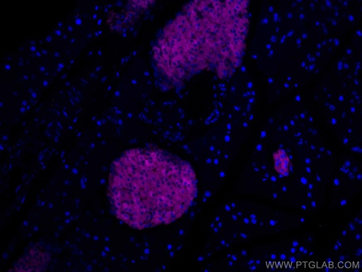 [CL647-17785-100UL] CoraLite®647-conjugated Synaptophysin Polyclonal antibody