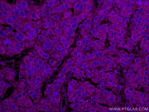 [CL647-67655-100UL] CoraLite®647-conjugated NCAPH Monoclonal antibody