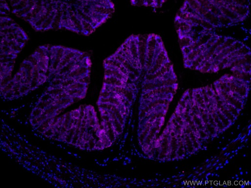 [CL647-67691-100UL] CoraLite®647-conjugated FABP2 Monoclonal antibody