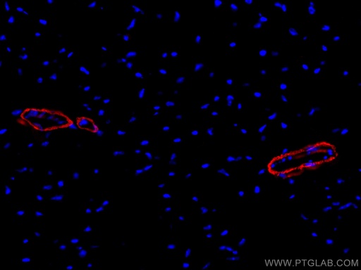 [CL647-67735-100UL] CoraLite®647-conjugated smooth muscle actin specific Monoclonal antibody