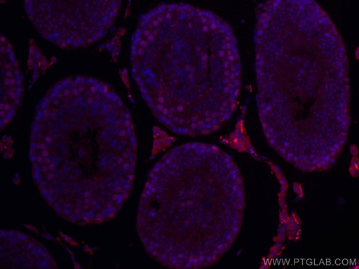 [CL647-67756-100UL] CoraLite®647-conjugated EED Monoclonal antibody