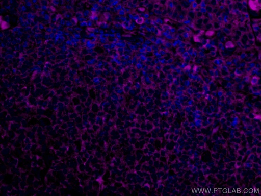 [CL647-67761-100UL] CoraLite®647-conjugated Human IgG Kappa chain Monoclonal antibody