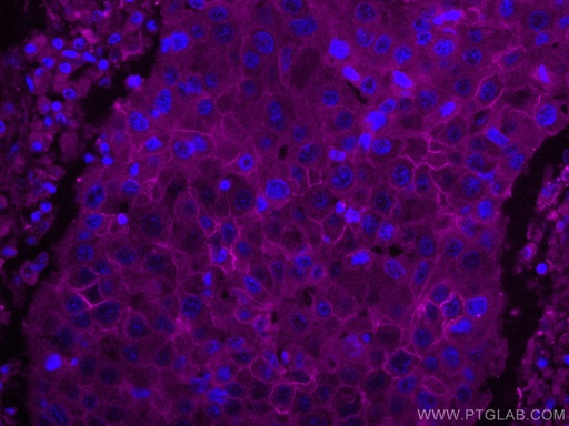 [CL647-67768-100UL] CoraLite®647-conjugated ALCAM Monoclonal antibody