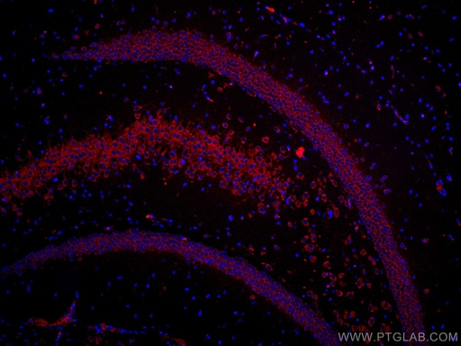 [CL647-67813-100UL] CoraLite®647-conjugated FXR1 Monoclonal antibody