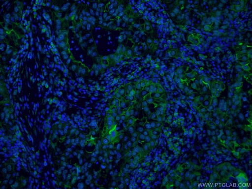 [FITC-60299-100UL] FITC-conjugated ICAM-1 Monoclonal antibody