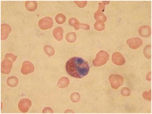 Giemsa stain